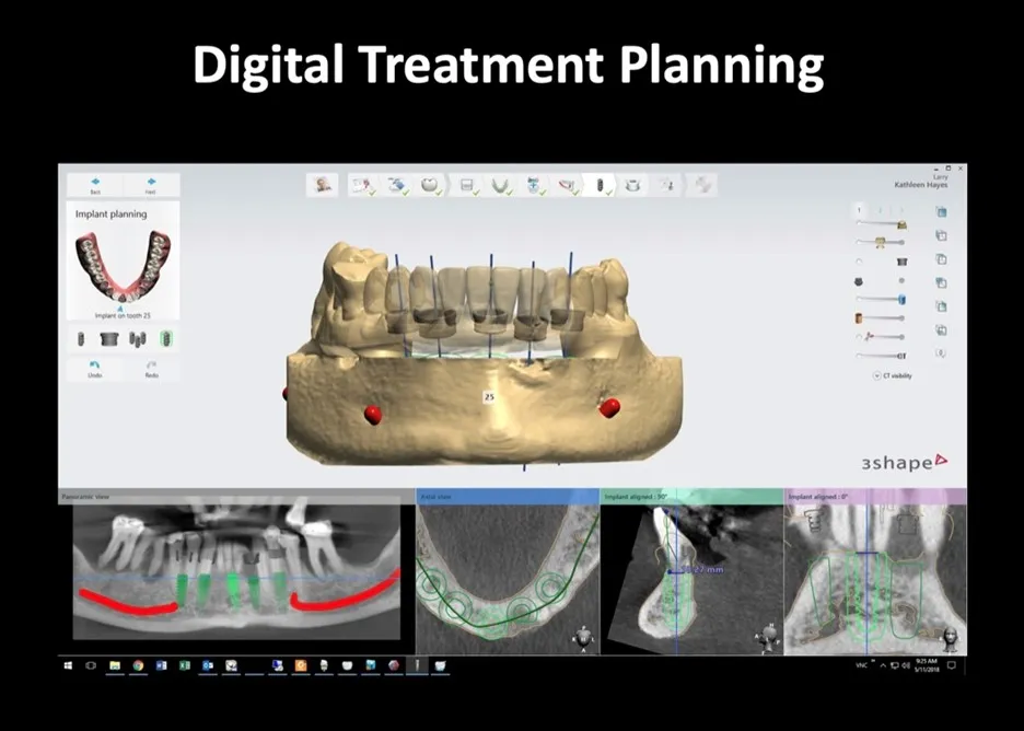 Digital Treatment Planning