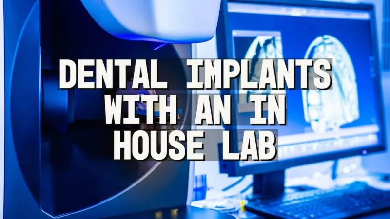 Dental Implants with an In-house Lab thumbnail