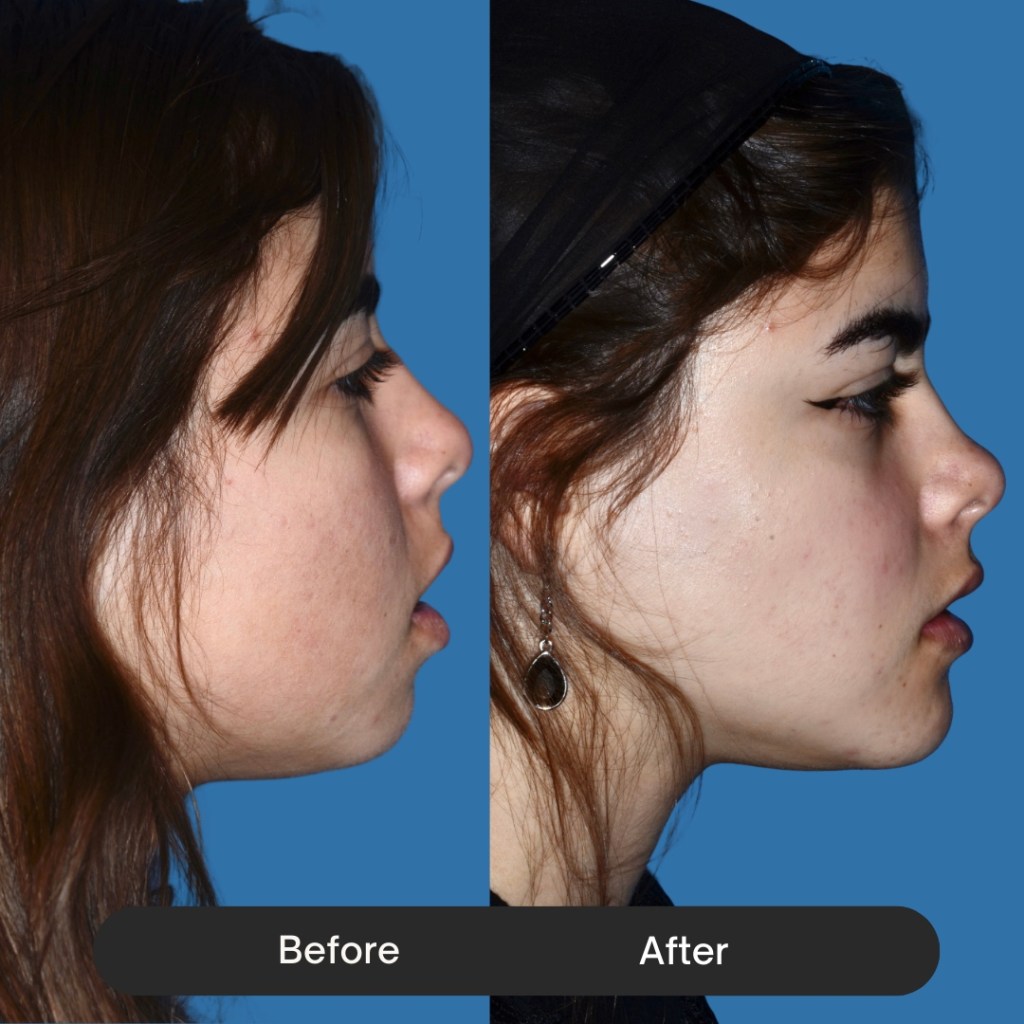 Side profile of a young woman. The 
