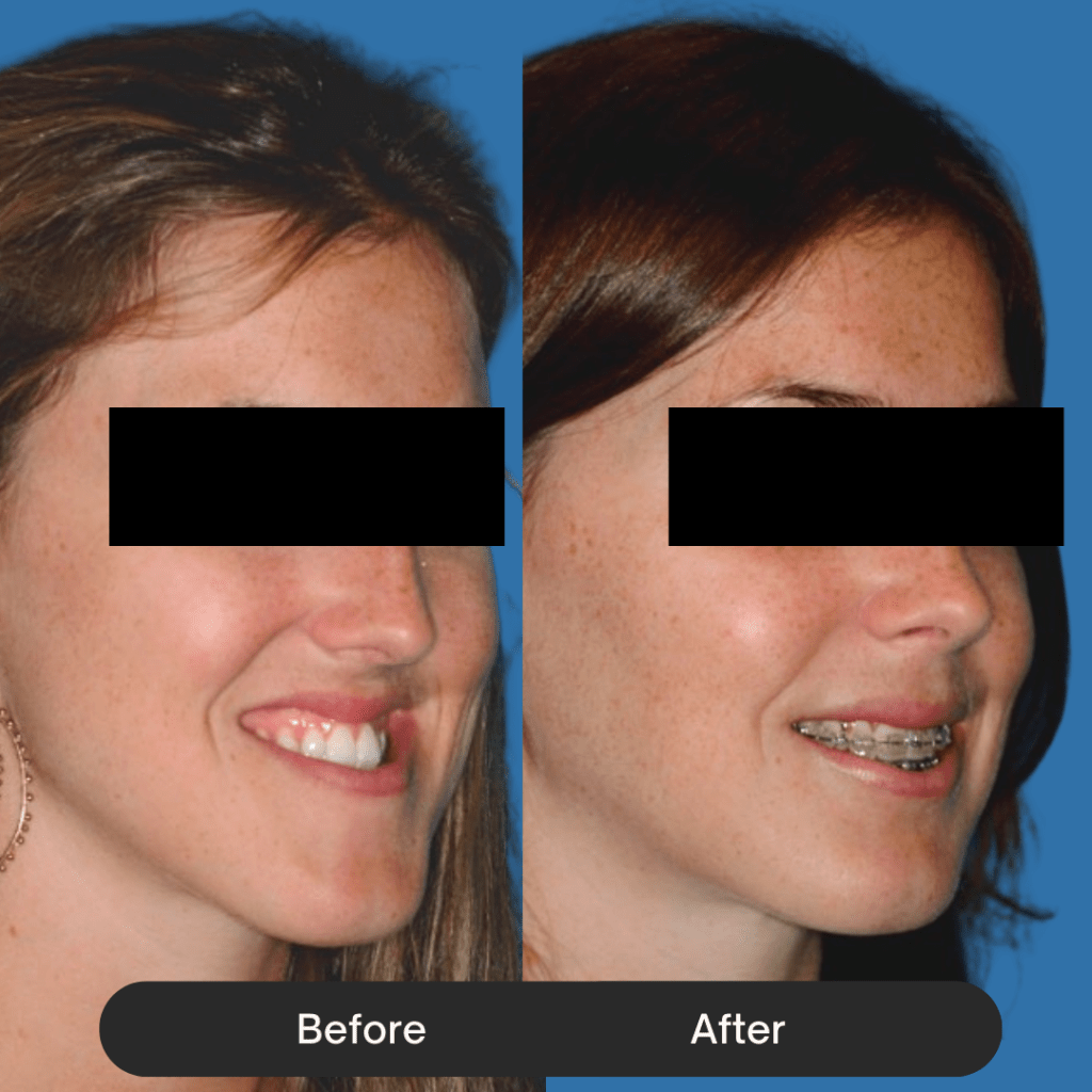 Profile of a woman smiling. The 